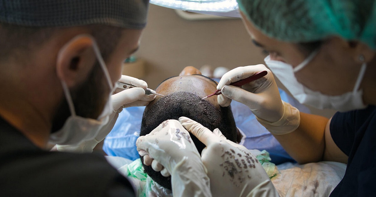 Planning for scalp treatment Korea clinic? Start Here